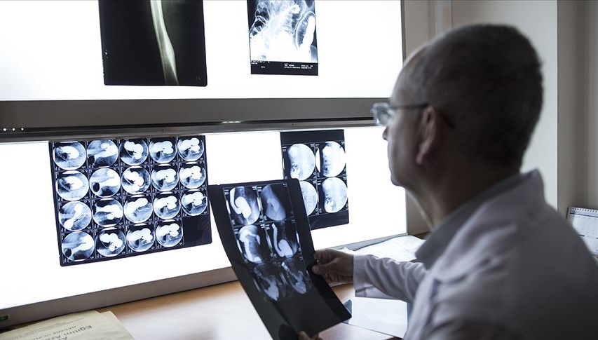 Göğüs kanserinde çığır açan buluş: “Akıllı bomba” tümörü yok edecek