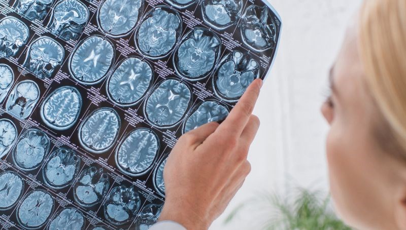 Kafatasını midesinde taşıdı