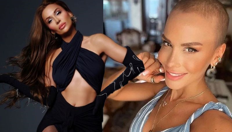 Müzikçi Şimal kanseri yenmişti: Son halini paylaştı