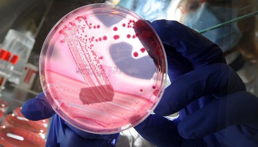 Prostat kanserinde yeni teşhis: Tükürükle tespit ediliyor