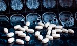 alzheimera-karsi-gunde-tek-bir-hap-umudu-insanlarda-test-ediliyor-2PATDZ4a.jpg