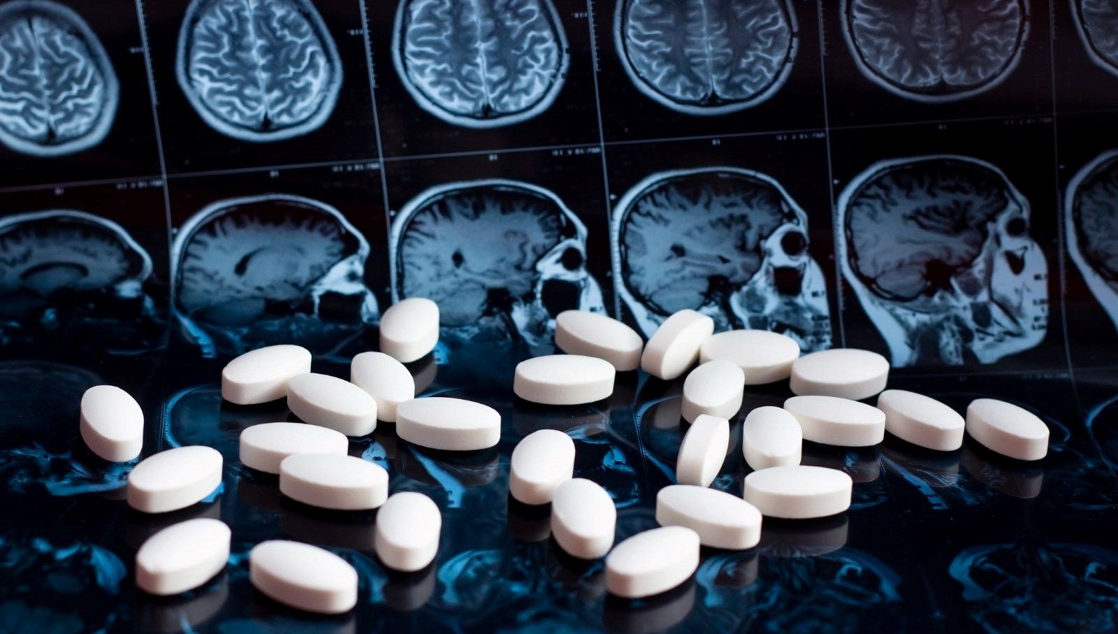 Alzheimer’a karşı günde tek bir hap umudu: İnsanlarda test ediliyor