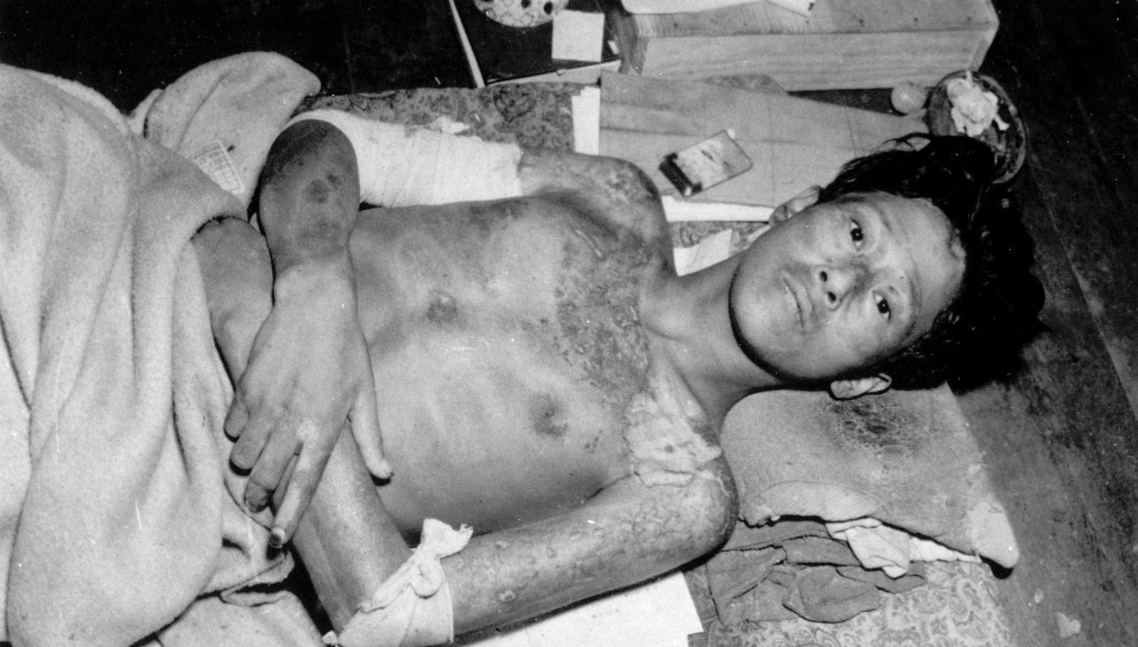 80 yıl sonra Nagasaki’den davet: Nükleer felaket kapıda