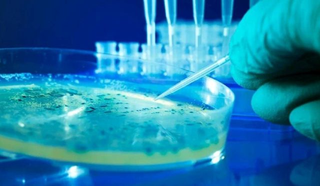 abdde-salmonella-alarmi-3spFYwwU.jpg