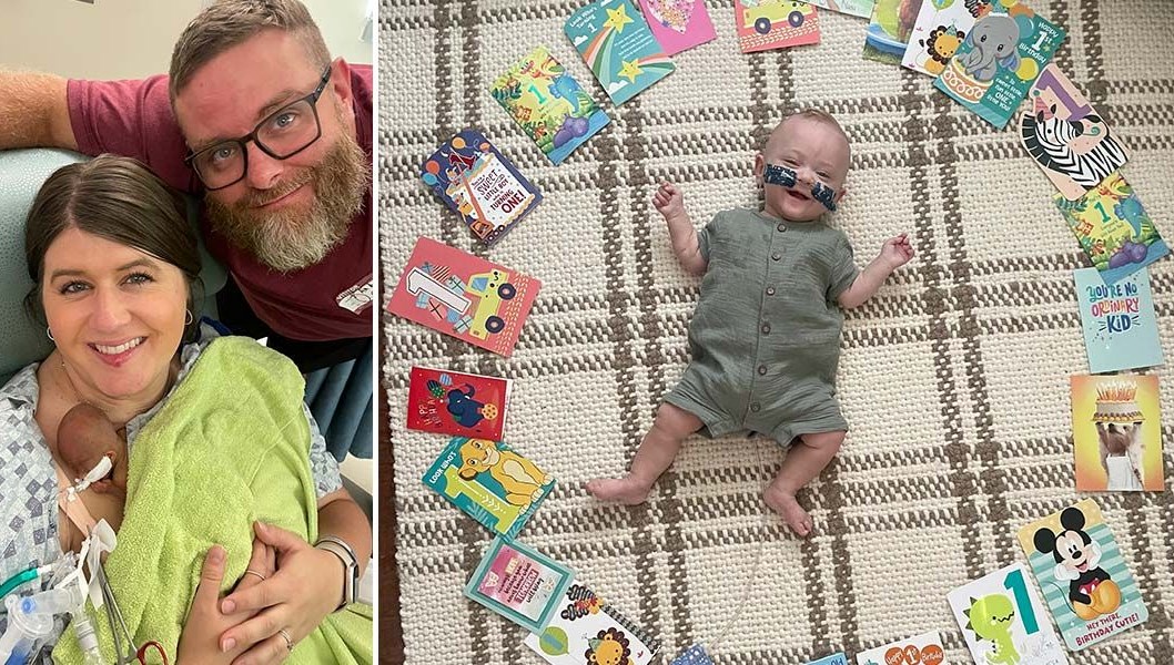 Dünyanın en prematüre bebeği: 280 gram doğdu, tabipler yaşamaz dedi