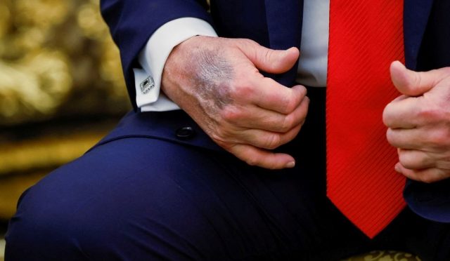 trumpin-eli-yeniden-gundem-oldu-beyaz-saraydan-aciklama-geldi-IXIWqLD5.jpg